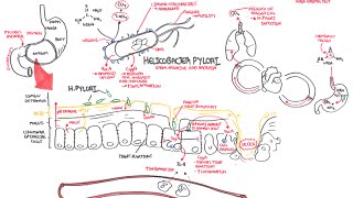 Microbiology  Helicobacter Pylori Ulcer [upl. by Oalsinatse]