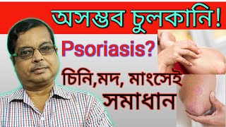 Psoriasis in Bengali  Discussion and Treatment in Homeopathy  সম্পূর্ণ চিকিৎসা  Home remedies [upl. by Etteniotna700]